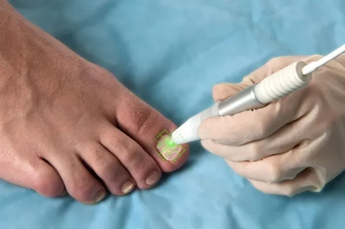 Foot trooper : πού να αγοράσετε σε φαρμακείο στην Ελλάδα;